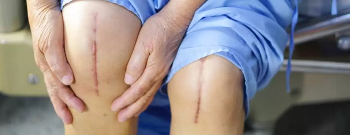 Diz protezini geciktirmenin ipuçları 